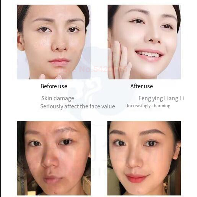 ไมโครนีดเดิล 0.25 มม. GHK-Cu บ - Valerian Root Capsule บทวิจารณ์และราคา